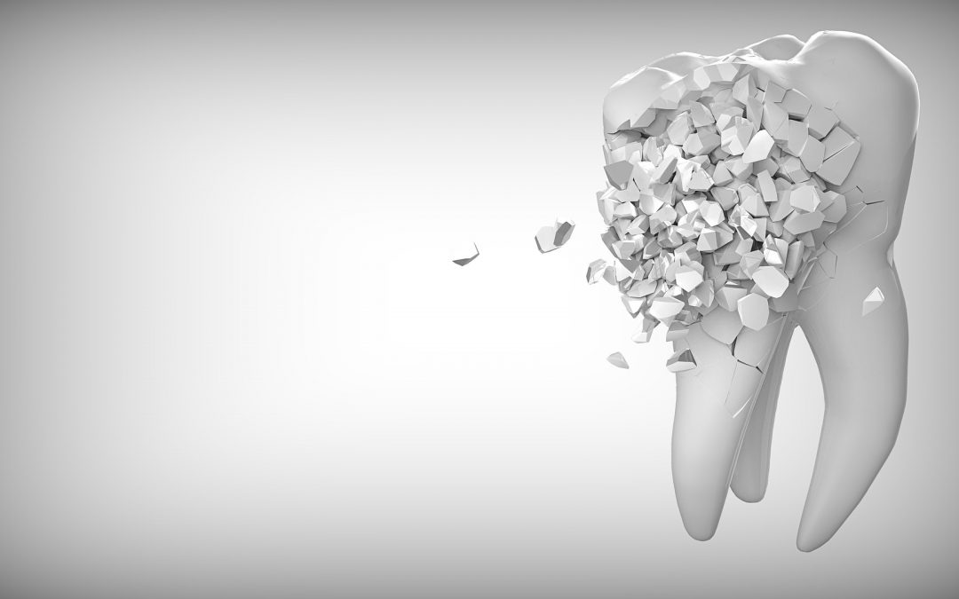 Four Reasons You Might Need Porcelain Dental Crowns